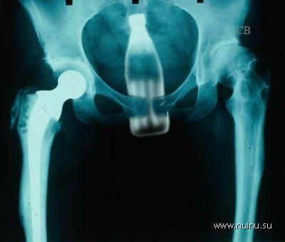 Необычные рентгеновские снимки (16 фото)